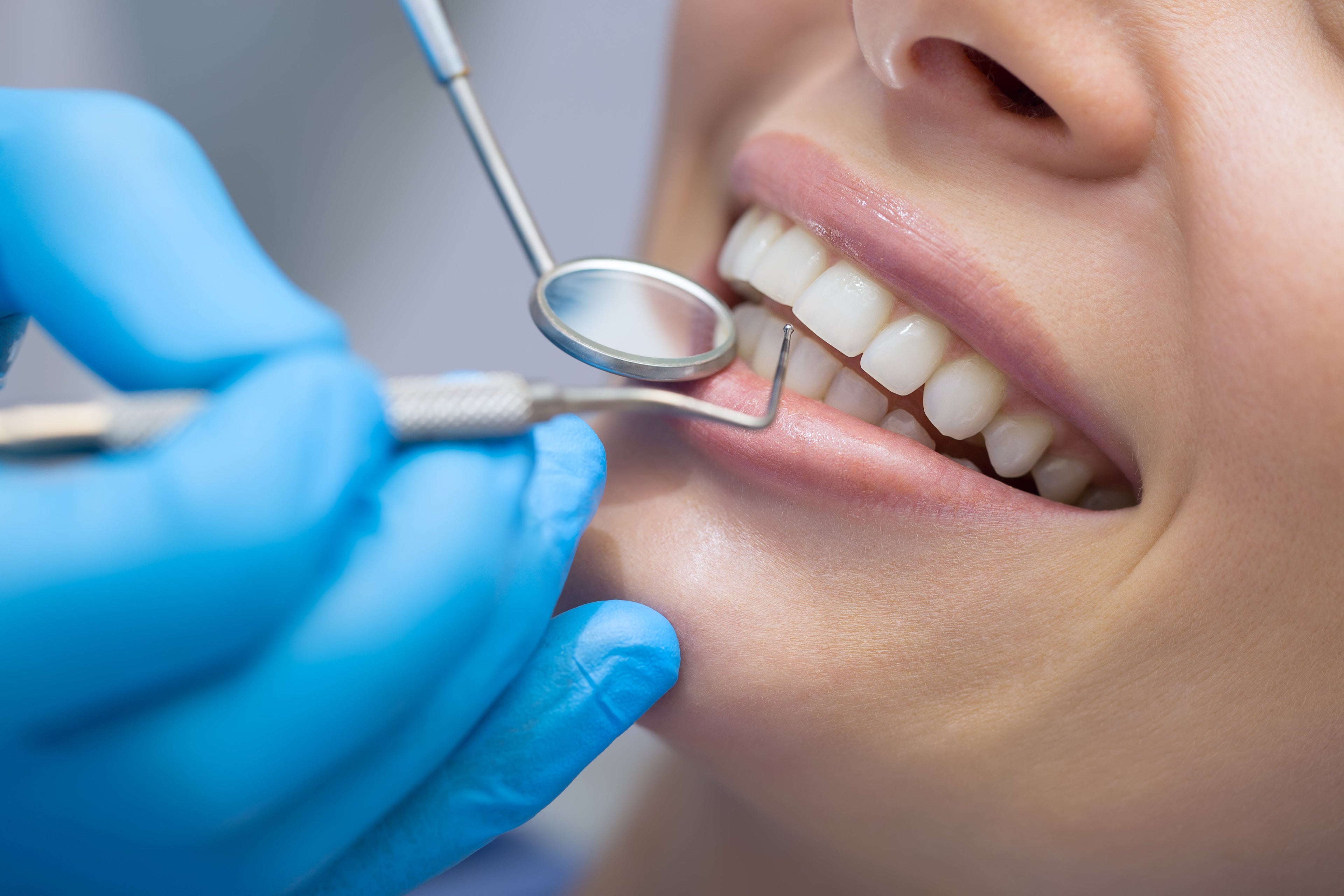 Oral Hygiene & Prevention
