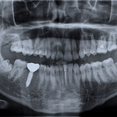 Collection image for: X-ray