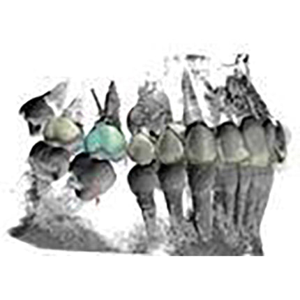 3Shape Orthodontic Planner 