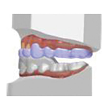 3Shape Appliance Designer Stand-alone 