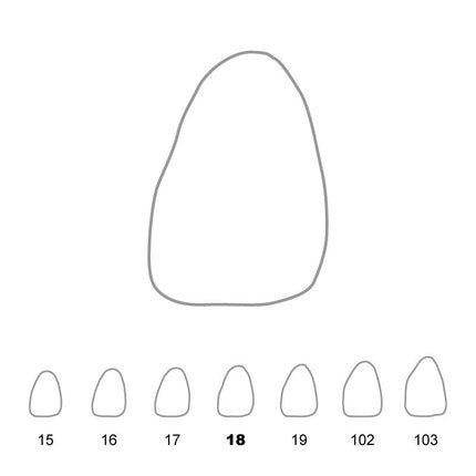 Temporary Crowns Upper Central Incisors Left 18 