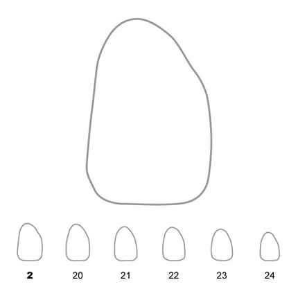 Temporary Crowns Upper Lateral Incisors Right 2 