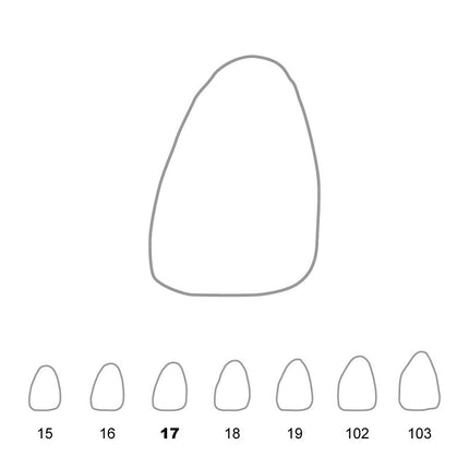 Temporary Crowns Upper Central Incisors Left 17 