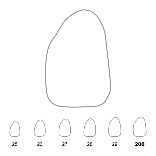 Temporary Crowns Upper Lateral Incisors Left 200 