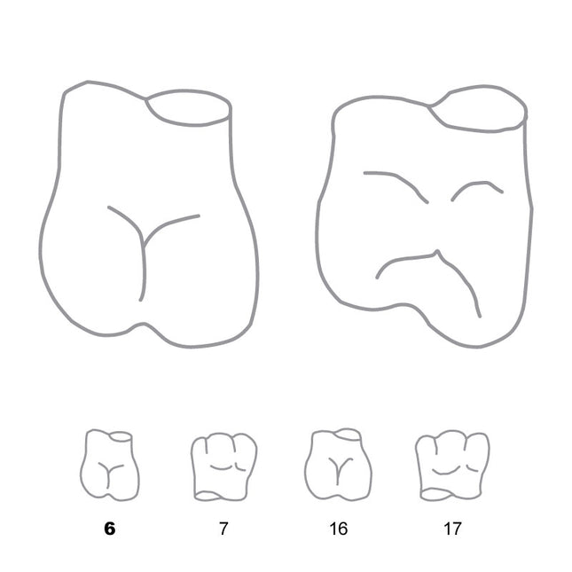 Odus Pella Transparent Crown Forms Molar 6 