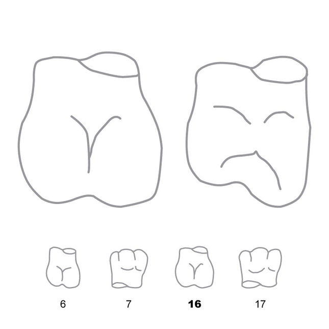 Odus Pella Transparent Crown Forms Molar 16 