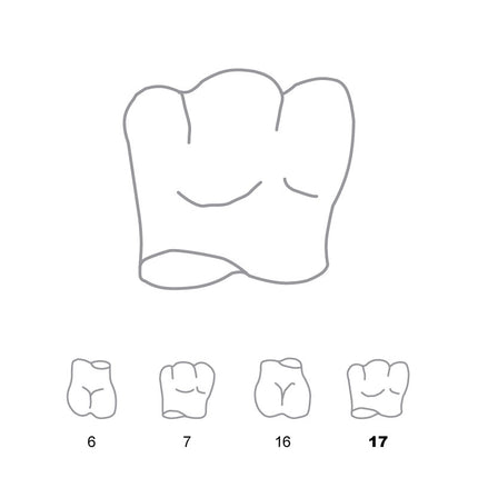 Odus Pella Transparent Crown Forms Molar 17 
