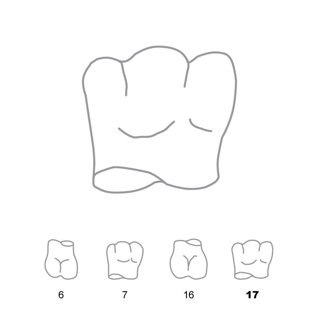 Odus Pella Transparent Crown Forms Molar 17 
